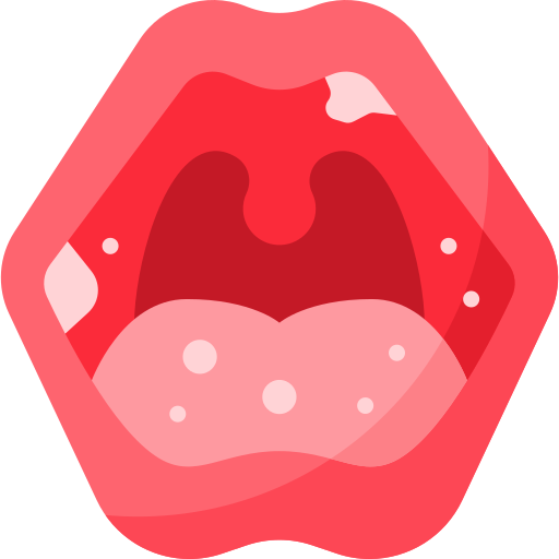 mouth ulcers